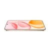 صورة هونر 400 - 5G